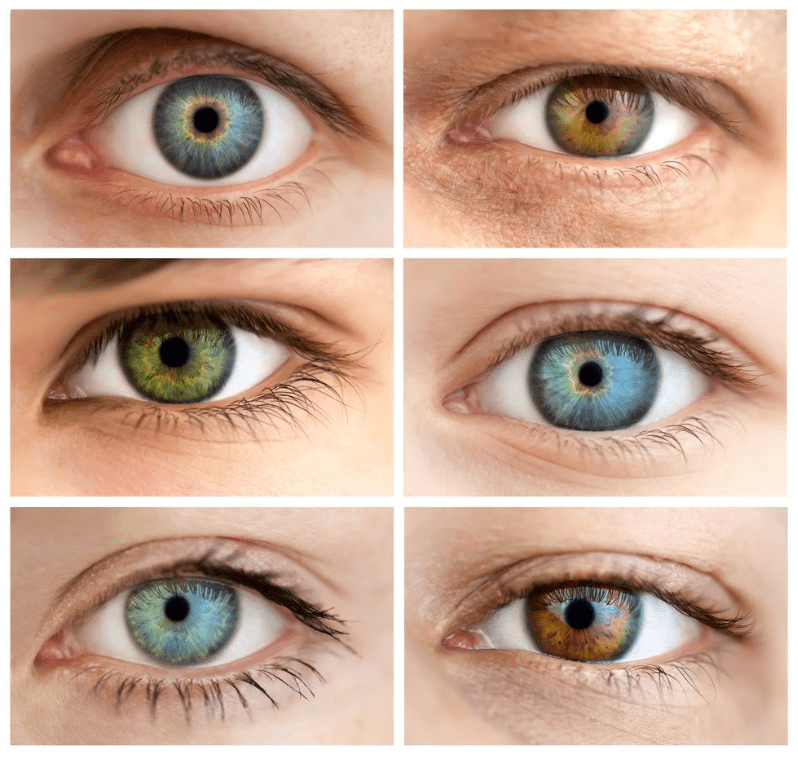 Photo of eyes treated with LASIK and they look great